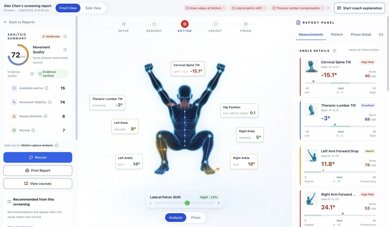 Movement analysis — Actual Crosspoint X report interface showing posture, left–right symmetry or movement analysis with synthetic demo photos and simulated measurements