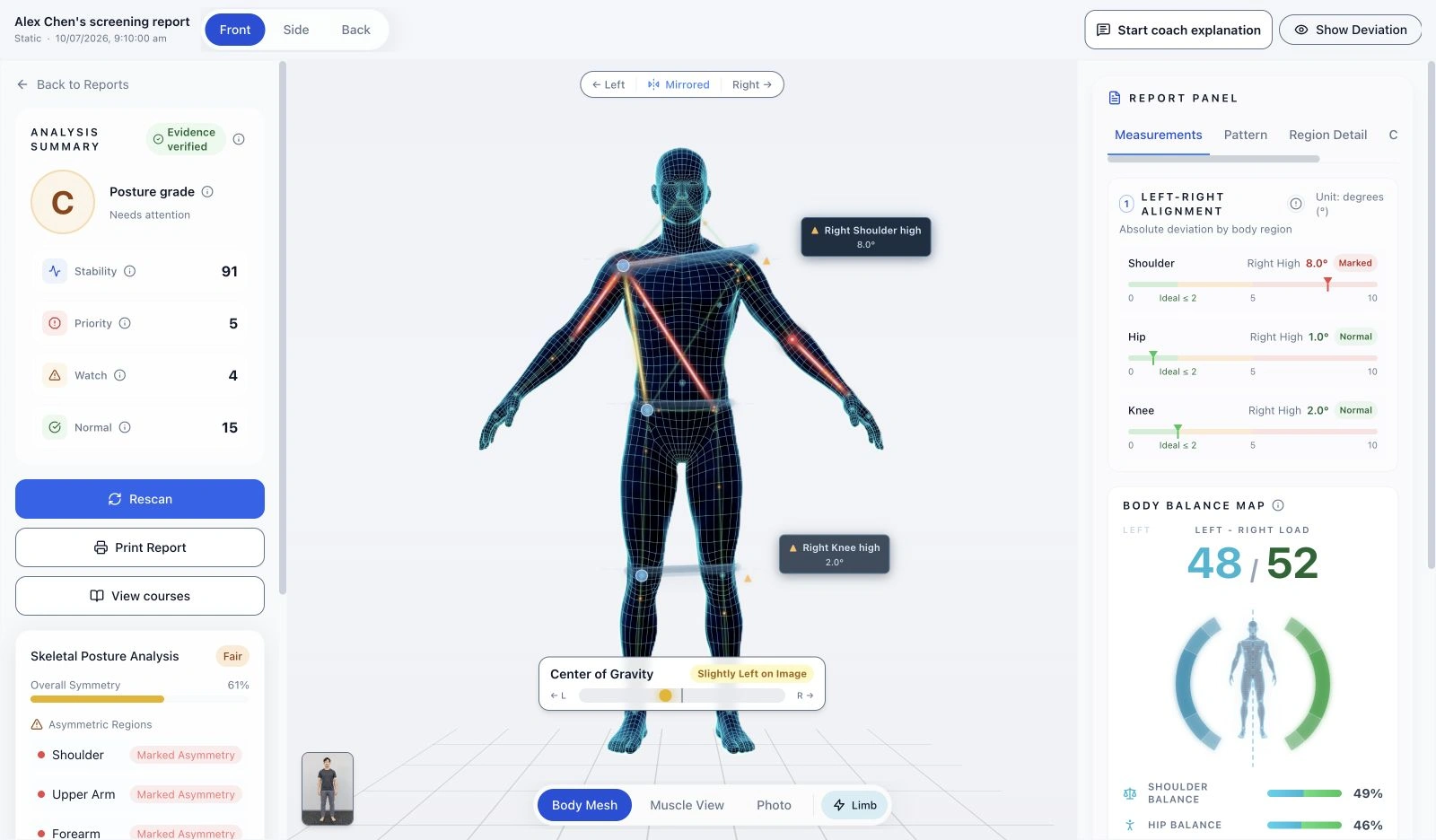 Crosspoint X posture report using synthetic demonstration data